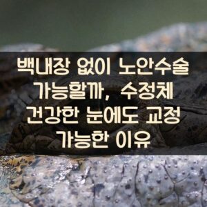 백내장 없이 노안수술 가능할까, 수정체 건강한 눈에도 교정 가능한 이유