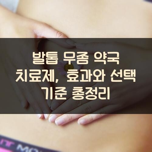 발톱 무좀 약국 치료제, 효과와 선택 기준 총정리